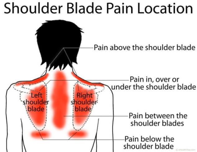 Широчайшие мышцы спины: как снять напряжение в лопаточной области