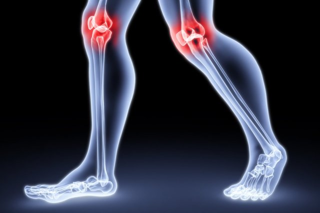 Методы лечения воспалительных заболеваний коленных суставов
