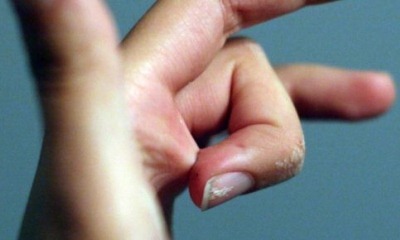 Как отклеить пальцы от суперклея